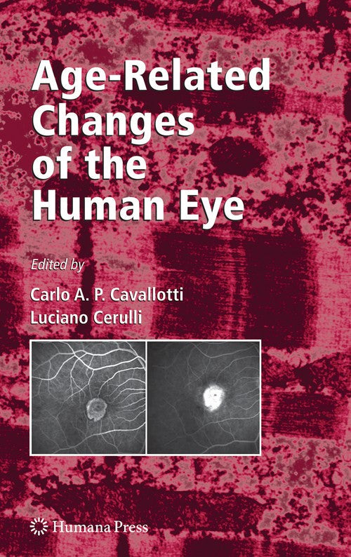 Age-Related Changes of the Human Eye by Carlo Cavallotti 9781934115558