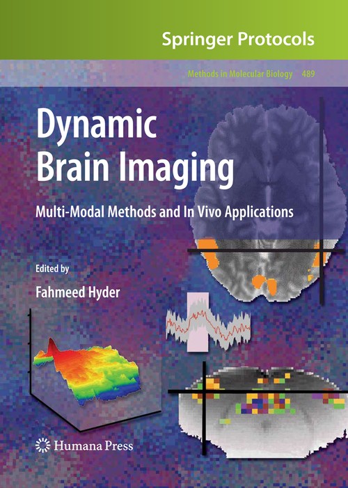 Dynamic Brain Imaging by Fahmeed Hyder 9781934115749