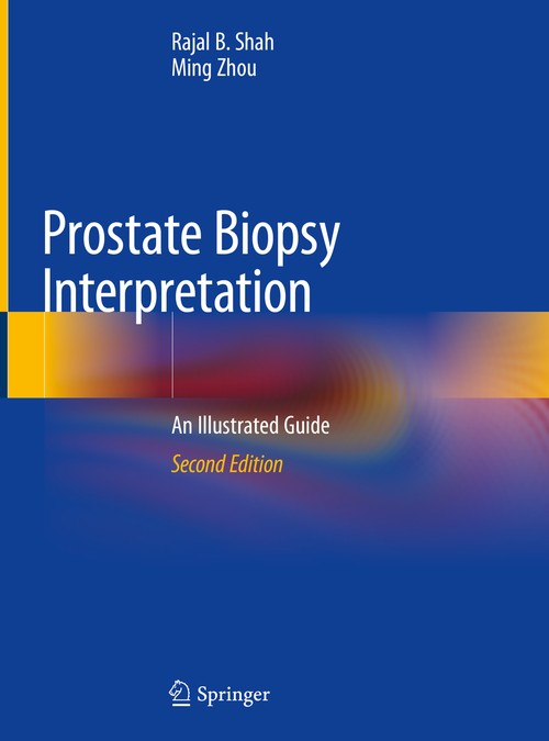 Prostate Biopsy Interpretation by Rajal B Shah ISBN 9783030136000
