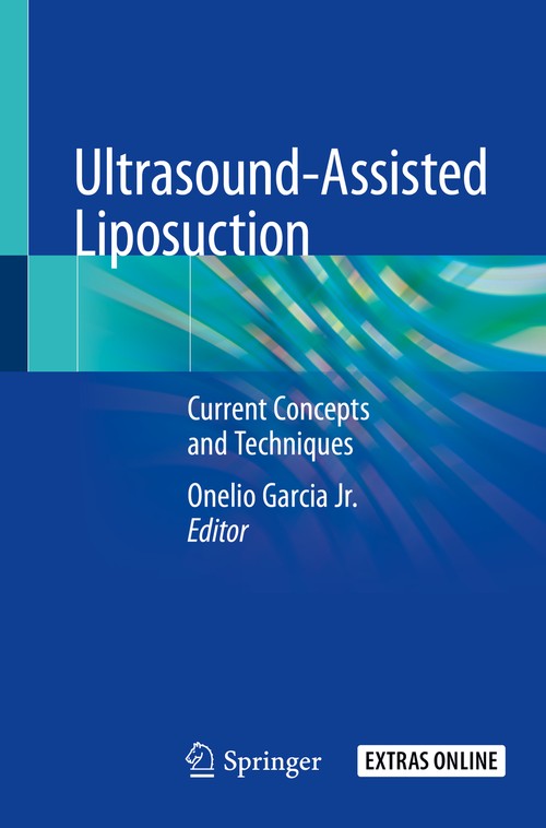 Ultrasound-Assisted Liposuction by Onelio Garcia Jr ISBN 9783030268770