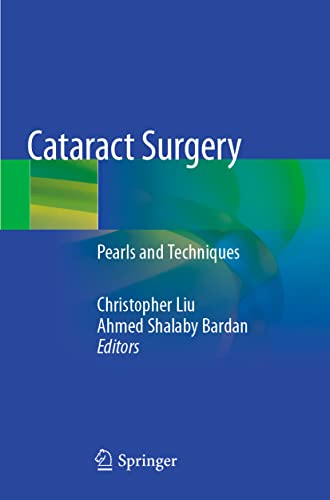 Cataract Surgery by Christopher Liu ISBN 9783030382360