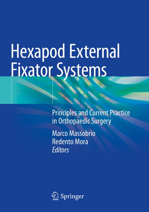 Hexapod External Fixator Systems by Marco Massobrio ISBN 9783030406691