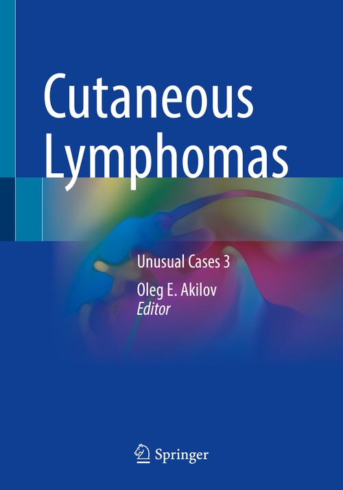Cutaneous Lymphomas by Oleg E Akilov ISBN 9783030591311