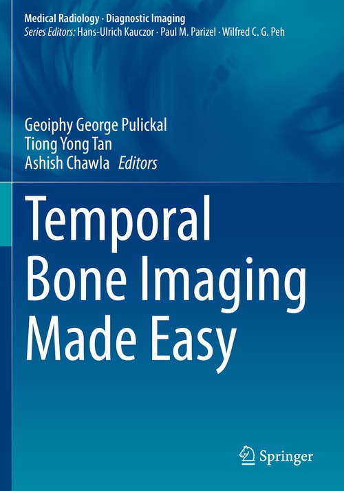 Temporal Bone Imaging Made Easy by Geoiphy George Pulickal ISBN 9783030706371
