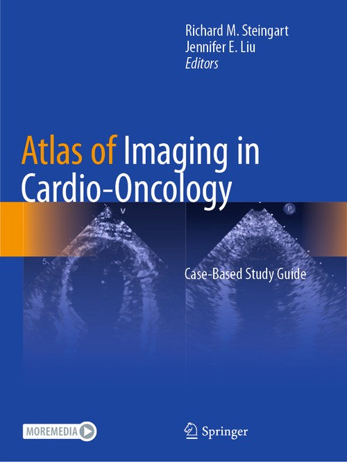 Atlas of Imaging in Cardio-Oncology by Richard M Steingart ISBN 9783030710002