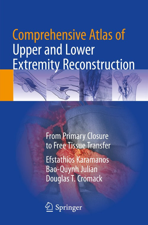 Comprehensive Atlas of Upper and Lower Extremity Reconstruction by Efstathios Karamanos ISBN 9783030742348