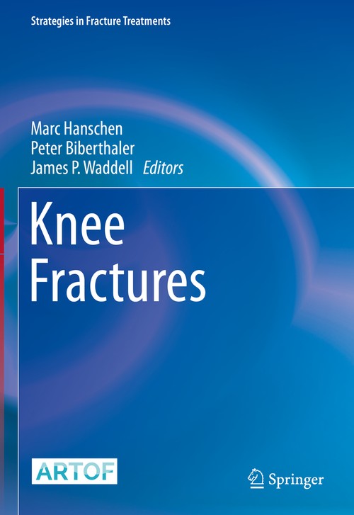 Knee Fractures by Marc Hanschen ISBN 9783030817756