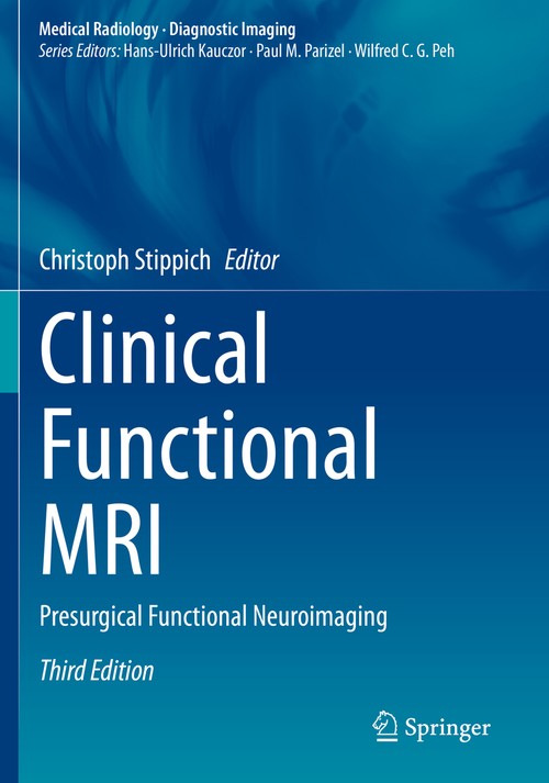 Clinical Functional MRI by Christoph Stippich ISBN 9783030833459