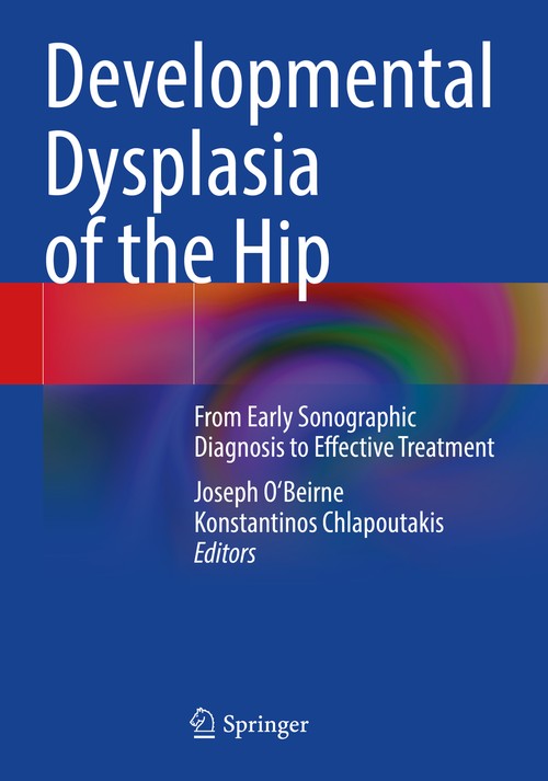 Developmental Dysplasia of the Hip by Joseph O'beirne ISBN 9783030949587