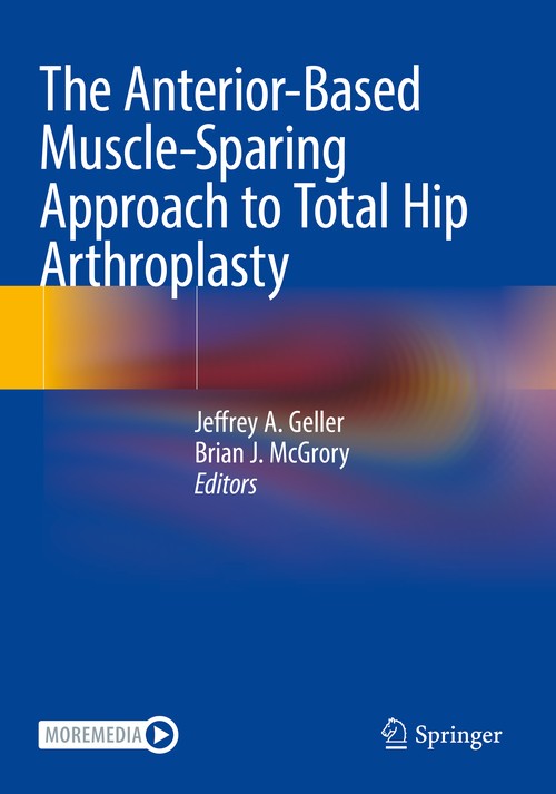 The Anterior-Based Muscle-Sparing Approach to Total Hip Arthroplasty by Jeffrey A Geller ISBN 9783031020612