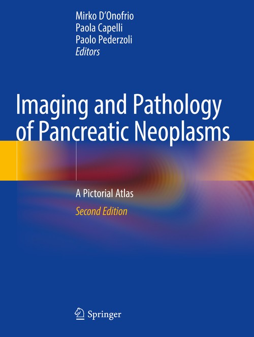 Imaging and Pathology of Pancreatic Neoplasms by Mirko D'onofrio ISBN 9783031098338