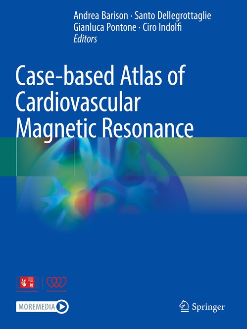 Case-based Atlas of Cardiovascular Magnetic Resonance by Andrea Barison ISBN 9783031325953