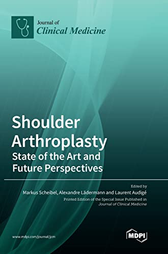 Shoulder Arthroplasty by Markus Scheibel ISBN 9783036564562