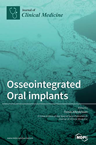 Osseointegrated Oral implants by Tomas Albrektsson ISBN 9783039366408