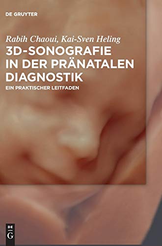 3D-Sonografie in der pranatalen Diagnostik by Rabih Chaoui ISBN 9783110471311