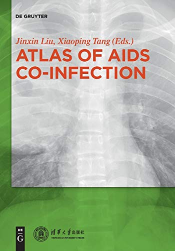 Atlas of AIDS Co-infection by Liu Jinxin ISBN 9783110579895