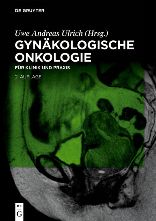 Gynakologische Onkologie by Uwe Andreas Ulrich ISBN 9783110612615