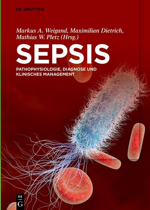 Sepsis by Markus Weigand ISBN 9783110673364