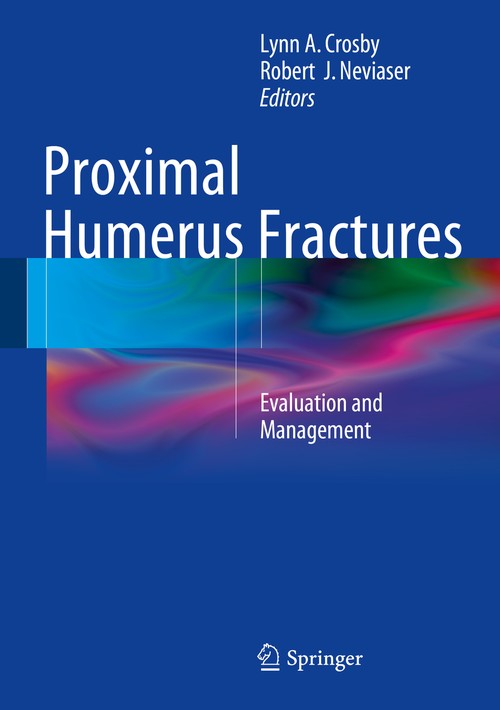 Proximal Humerus Fractures by Lynn A Crosby ISBN 9783319089508