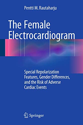 The Female Electrocardiogram by Pentti M Rautaharju ISBN 9783319152929