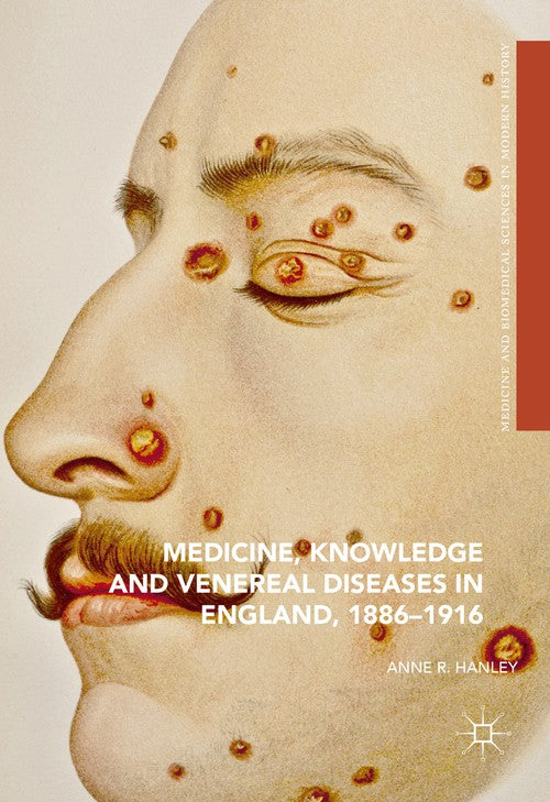 Medicine, Knowledge and Venereal Diseases in England, 1886-1916 by Anne R Hanley