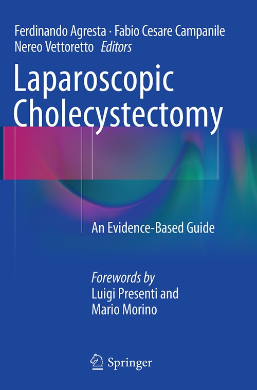 Laparoscopic Cholecystectomy by Ferdinando Agresta ISBN 9783319351919