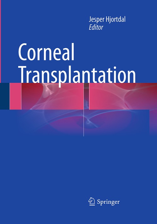 Corneal Transplantation by Jesper Hjortdal ISBN 9783319352718