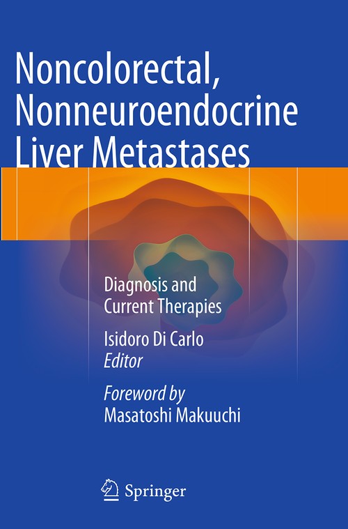 Noncolorectal, Nonneuroendocrine Liver Metastases by Isidoro Di Carlo