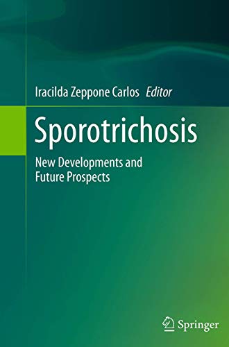 Sporotrichosis by Iracilda Zeppone Carlos ISBN 9783319372570