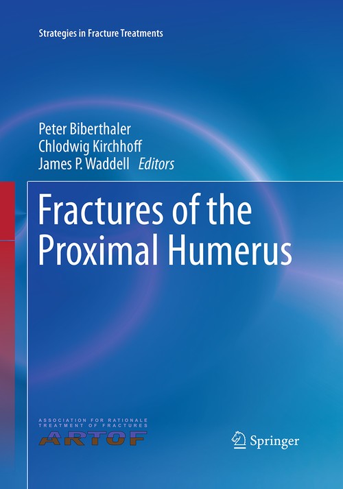Fractures of the Proximal Humerus by Peter Biberthaler ISBN 9783319373256