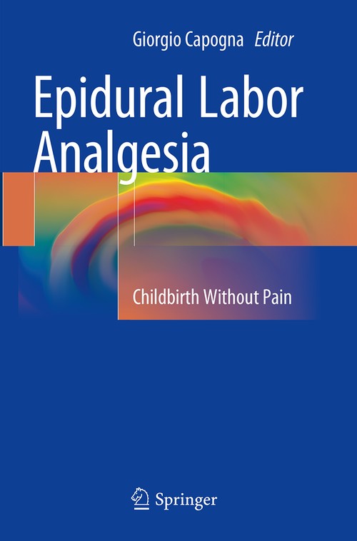 Epidural Labor Analgesia by Giorgio Capogna ISBN 9783319376738