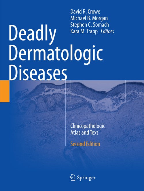 Deadly Dermatologic Diseases by David R Crowe ISBN 9783319810652