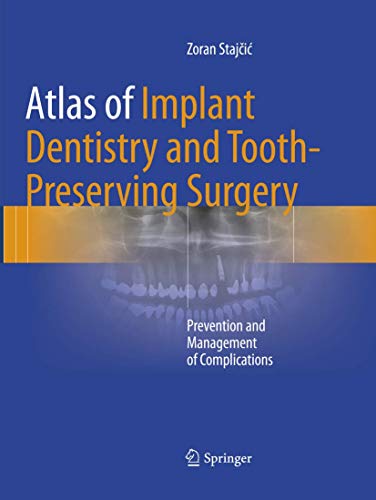 Atlas of Implant Dentistry and Tooth-Preserving Surgery by Zoran Stajic ISBN 9783319825038