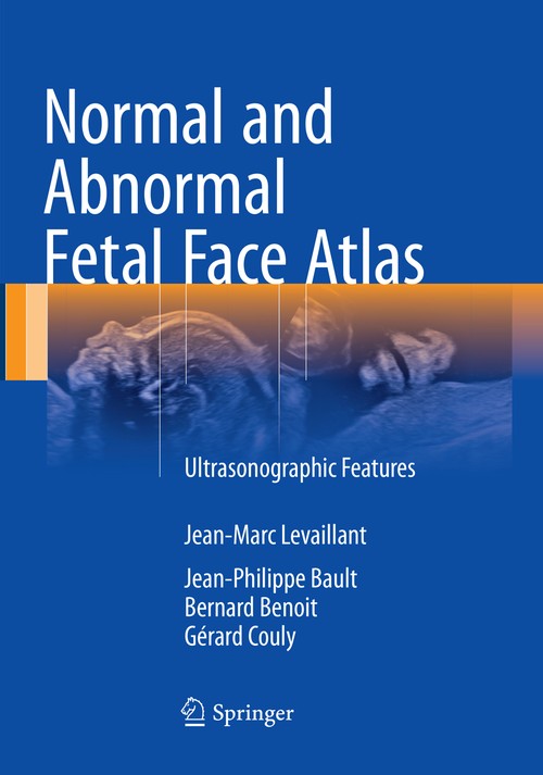 Normal and Abnormal Fetal Face Atlas by Jean-Marc Levaillant ISBN 9783319829067