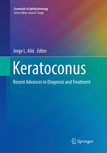 Keratoconus by Jorge Ali ISBN 9783319829333