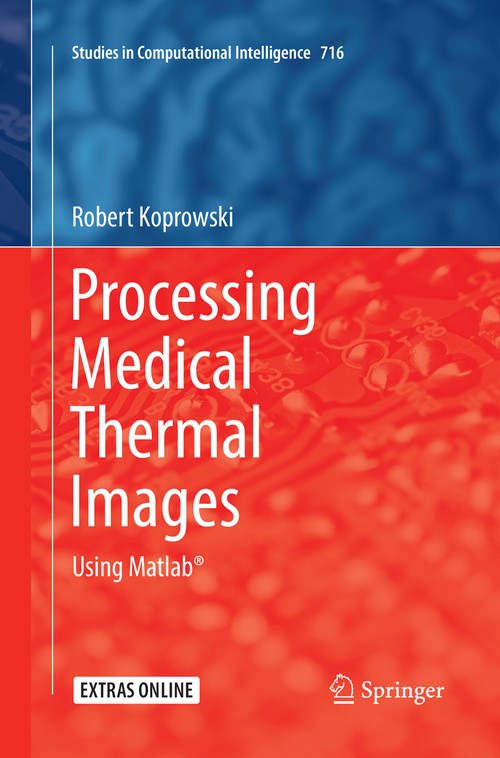 Processing Medical Thermal Images by Robert Koprowski ISBN 9783319870564