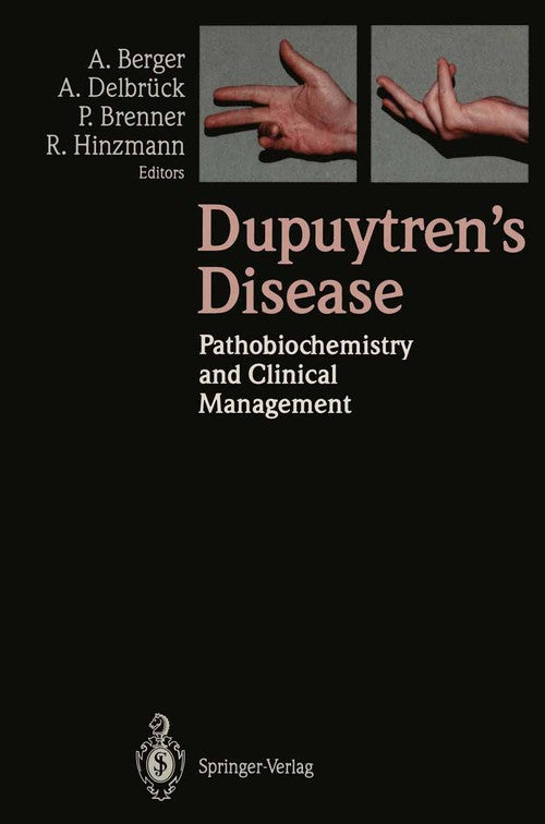 Dupuytren’s Disease by Alfred Berger | ISBN-13 9783540572398