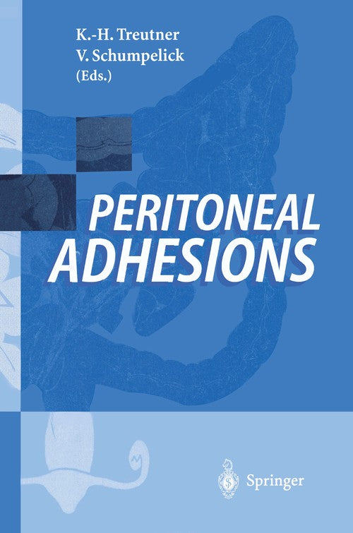 Peritoneal Adhesions by Karl-Heinz Treutner | ISBN-13 9783540611929