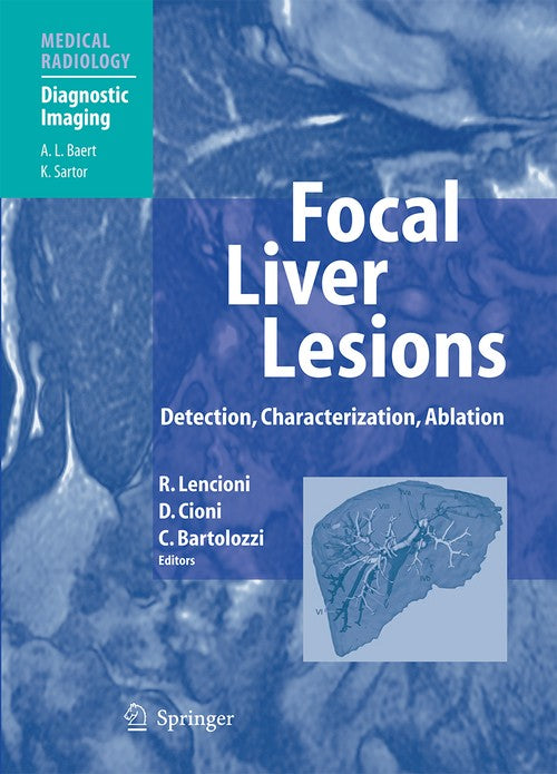 Focal Liver Lesions by Riccardo Lencioni | ISBN-13 9783540644644