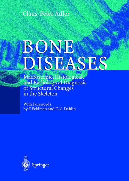 Bone Diseases by Claus-Peter Adler | ISBN-13 9783540650614