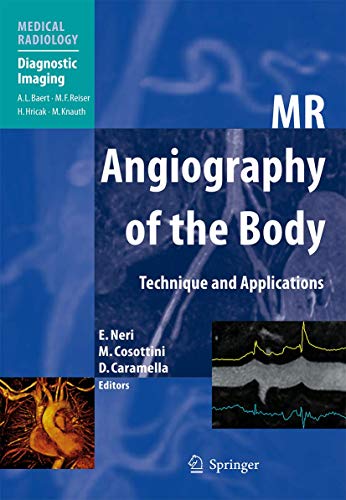 MR Angiography of the Body by Emanuele Neri | ISBN-13 9783540797166