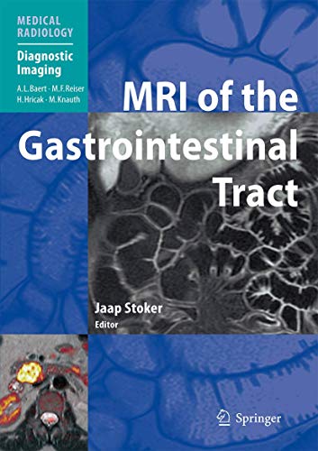 MRI of the Gastrointestinal Tract by Jaap Stoker | ISBN-13 9783540855316