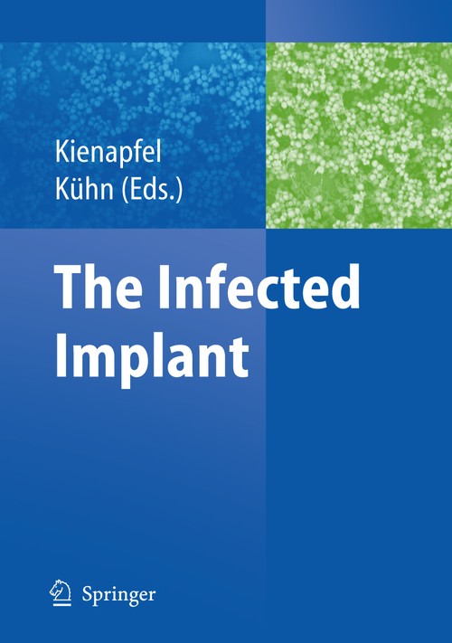 The Infected Implant by Heino Kienapfel | ISBN-13 9783540928355