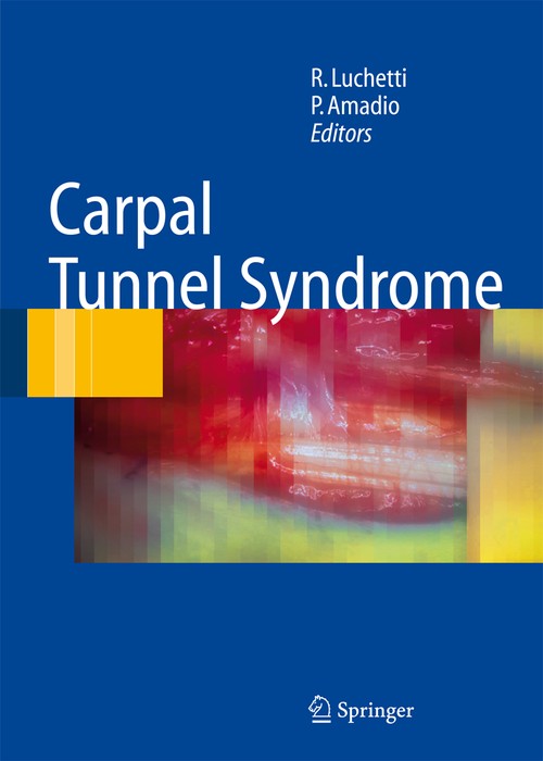 Carpal Tunnel Syndrome by Riccardo Luchetti | ISBN-13 9783642061196