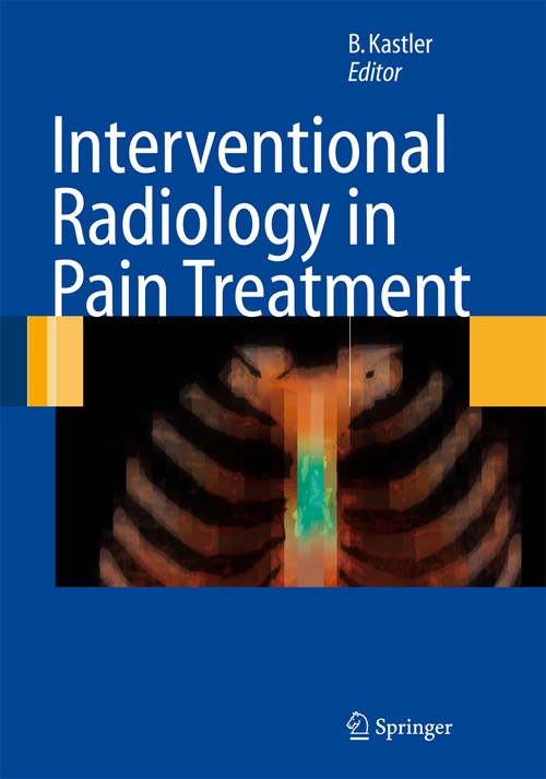 Interventional Radiology in Pain Treatment by F-G Barral | ISBN-13 9783642063947
