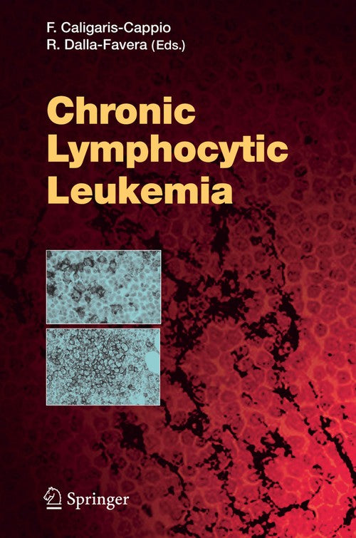 Chronic Lymphocytic Leukemia by Federico Caligaris-Cappio | ISBN-13 9783642064500