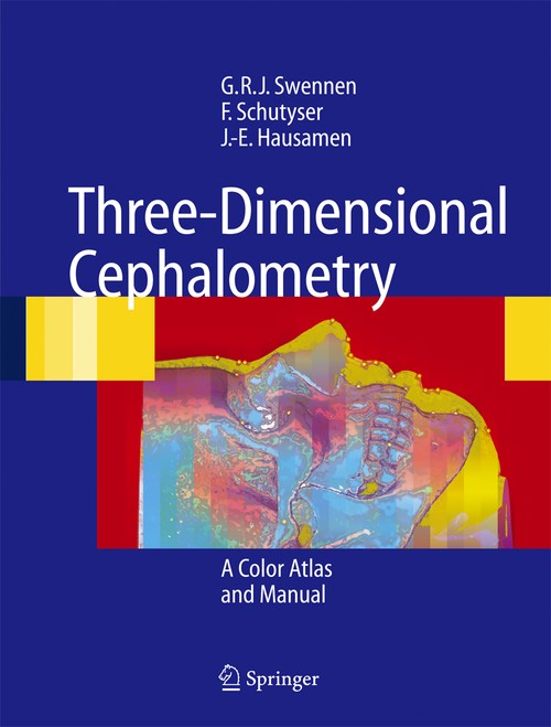 Three-Dimensional Cephalometry by Gwen Rj Swennen | ISBN-13 9783642064845