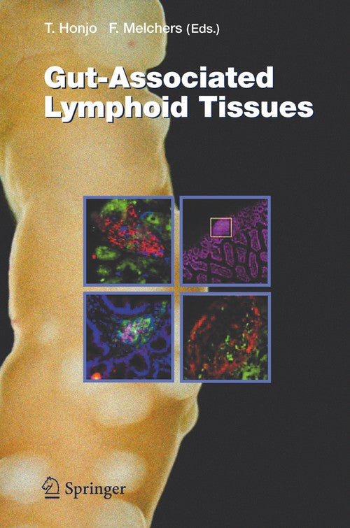 Gut-Associated Lymphoid Tissues by Tasuku Honjo | ISBN-13 9783642067945