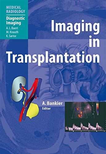 Imaging in Transplantation by Alexander A Bankier | ISBN-13 9783642072970