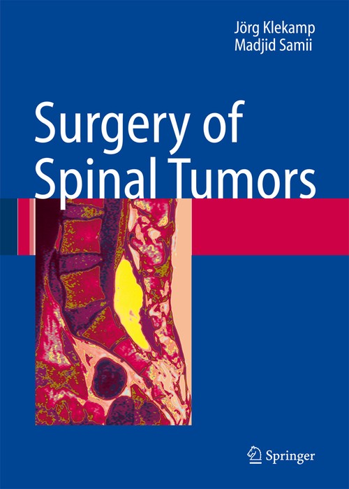Surgery of Spinal Tumors by Madjid Samii | ISBN-13 9783642079481